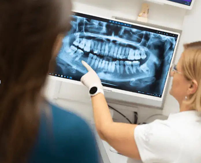 Najbolji izbor za zubne implantate i “All-on-4” u Rijeci: Smile Studio Najbolji izbor za zubne implantate i “All-on-4” u Rijeci: Smile Studio